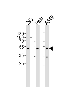CBX8 Antibody (C-term)