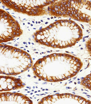 CAPN2 Antibody