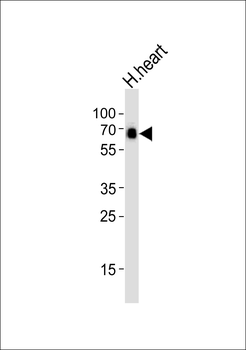 SMARCD3 Antibody (N-term)