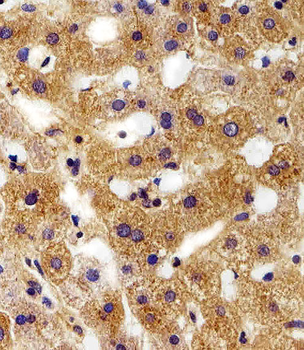 FXYD6 Antibody (C-term)