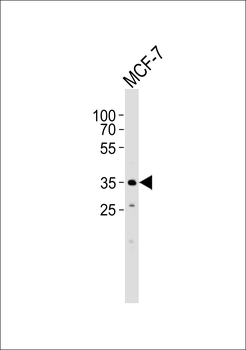 FBXL17 Isoform 2 Antibody (C-term)