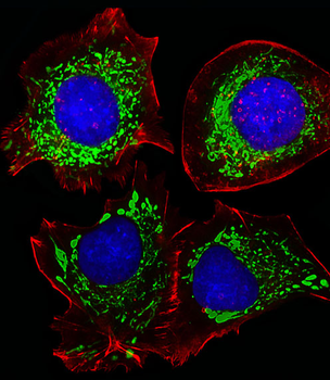 AK4 Antibody (Center)