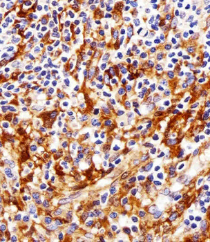 FYN Antibody