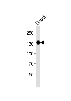 USP25 Antibody