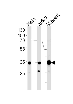 NDUFA9 Antibody (Center)