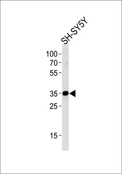 STX1B Antibody (N-term)