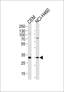 H2AFY2 Antibody (Center)