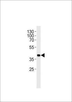 M Sh2d5 Antibody (Center)