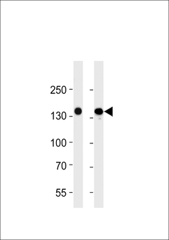 VEGFR3 Antibody