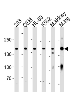PKP4 Antibody (C-term)