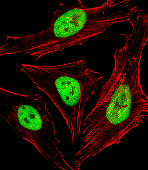 SAP30BP Antibody (Center)