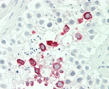 IFNA4 Antibody (C-term)