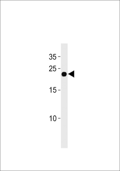 IFNA4 Antibody (C-term)