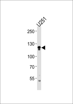 ECE2 Antibody (Center)