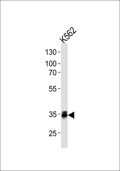 MBD3 Antibody (C-term)