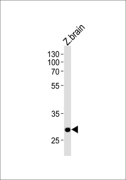 Zebrafish hoxc9a Antibody (C-term)