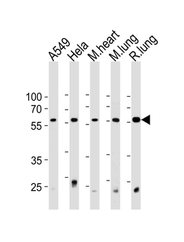 PRS4 Antibody (C-term)