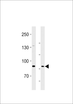SEMA6B Antibody (C-term)