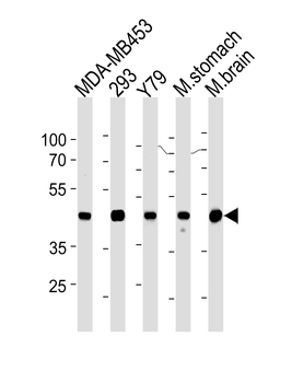 Creatine Kinase BB Antibody (Center)