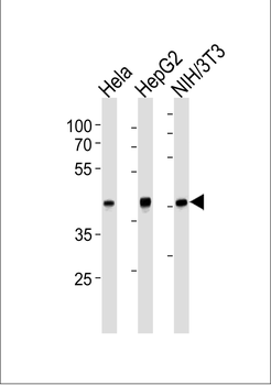 TBP Antibody