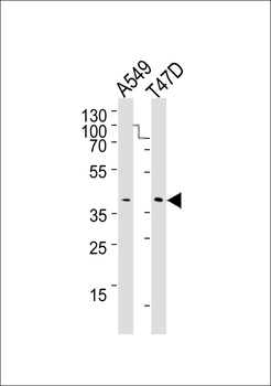 ERCC1 Antibody (C-term)
