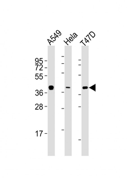 ERCC1 Antibody (C-term)