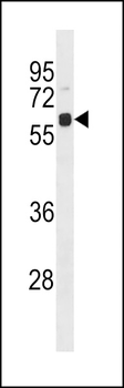 Ubiquilin 4 Antibody (N-term)