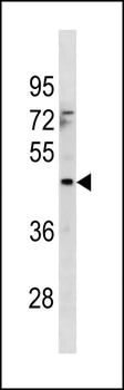 MTCH1 Antibody (Center)