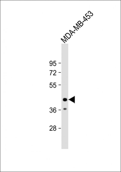 LMAN2L Antibody (C-term)