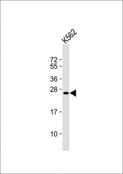LRRC61 Antibody (Center)