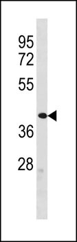 ZFP92 Antibody (N-term)