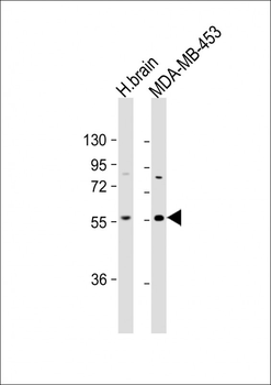 IGSF21 Antibody (N-term)