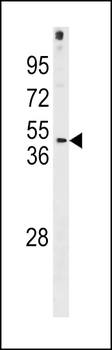FRA10AC1 Antibody (C-term)