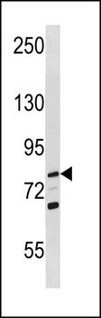 RECQL Antibody (Center)