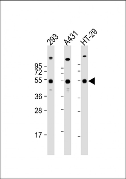 TP53 Antibody (C-term)