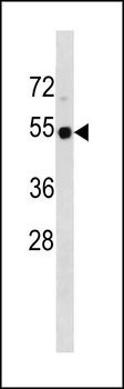 TP53 Antibody (Center)