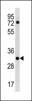 HLA-DOA Antibody (N-term)