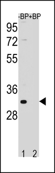 FAM26F Antibody (C-term)