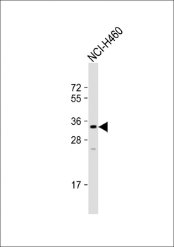 FAM26F Antibody (C-term)
