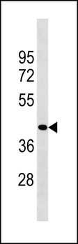 ZCCHC3 Antibody (Center)