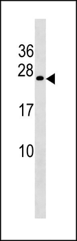 COX4NB Antibody (Center)