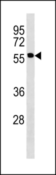 PNPLA2 Antibody (N-term)