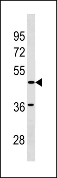 SGCE Antibody (C-term)