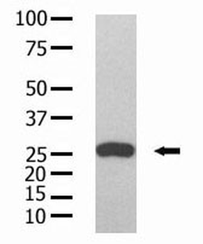 GST Tag Antibody