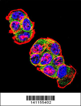 CTNNB1 Antibody (N-term)
