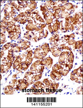 CTNNB1 Antibody (N-term)