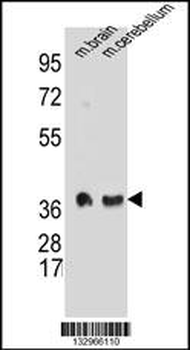 SYP Antibody(C-term)
