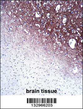 SYP Antibody(C-term)