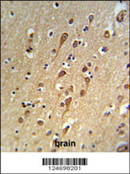 URG4 Antibody (Center)