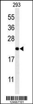 MRAP Antibody (N-term)